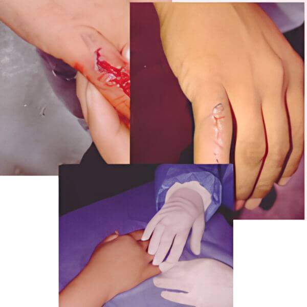 Hand physical therapy