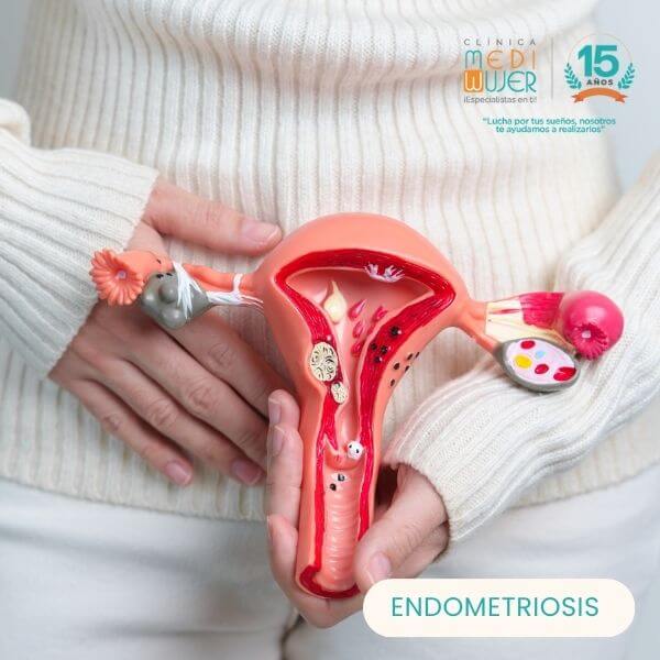 Endometriosis 