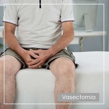 Vasectomía