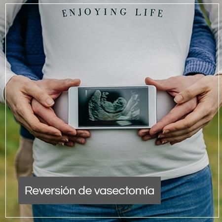 Reversión de vasectomía
