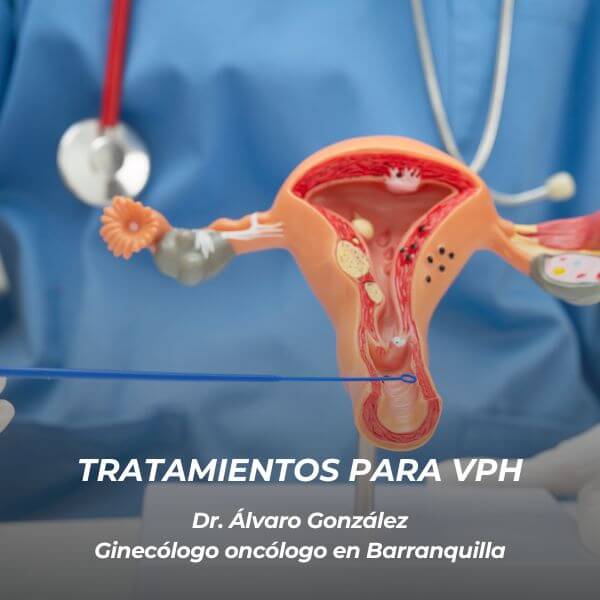 Tratamientos para VPH