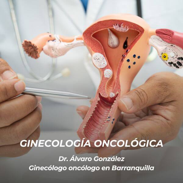 Consulta ginecología oncológica