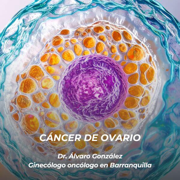 Cáncer de ovario