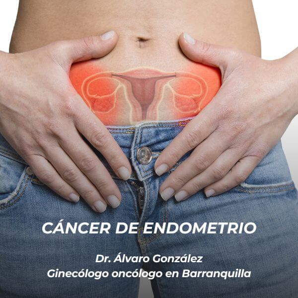 Cáncer de endometrio