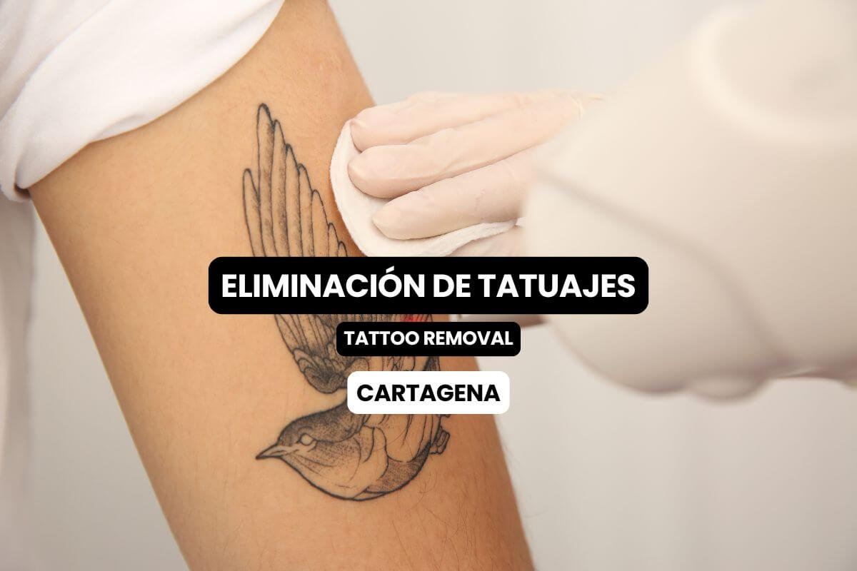 Eliminación de tatuajes en Cartagena con el Dr. Rodrigo Vélez