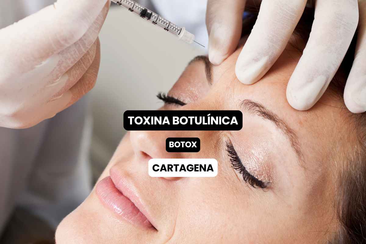 Aplicación de Toxina Botulínica en Cartagena con el Dr. Rodrigo Vélez