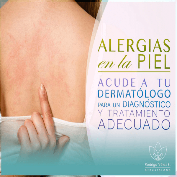 Alergias en la piel
