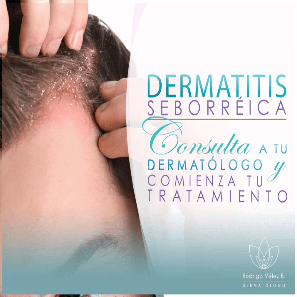 Dermatitis seborreica