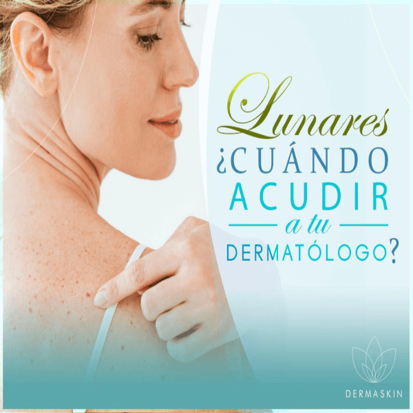 Eliminación de lunares