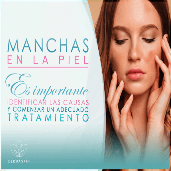 Manchas en la piel