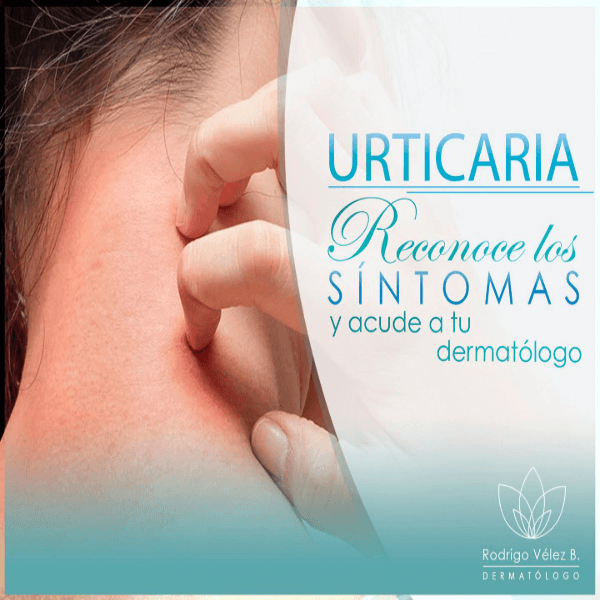 Tratamiento para urticaria