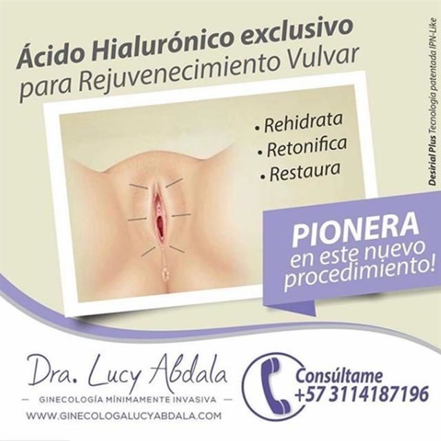 Hyaluronic Acid for Vulvar Rejuvenation