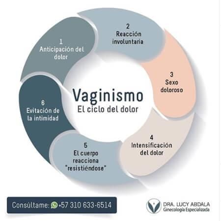 Vaginismo