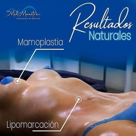 Breast augmentation surgery