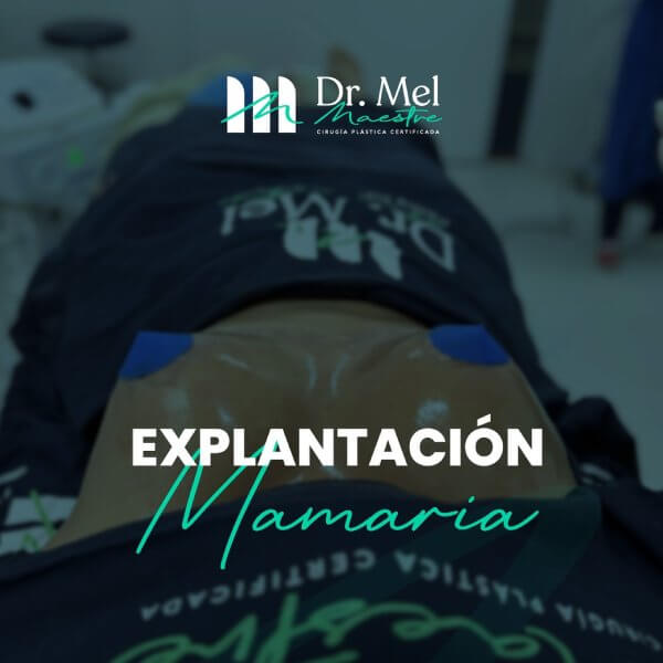 Explantación mamaria