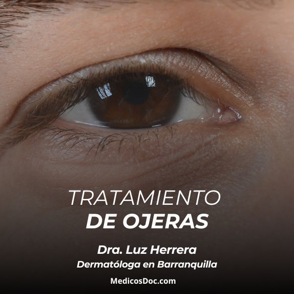 Tratamiento para ojeras