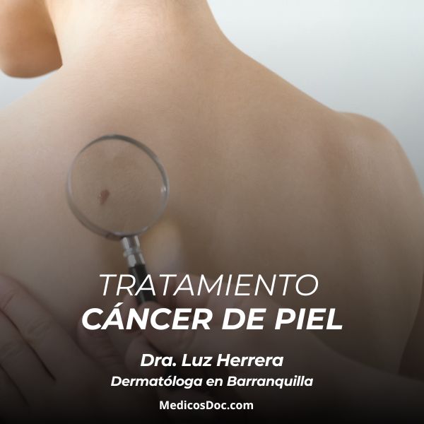 Skin cancer treatment