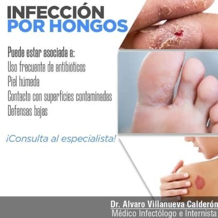 Infección por hongos