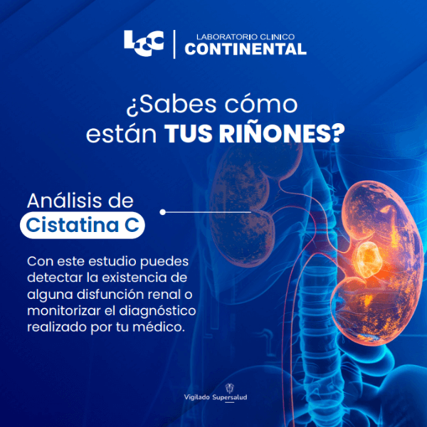 Cistatina C