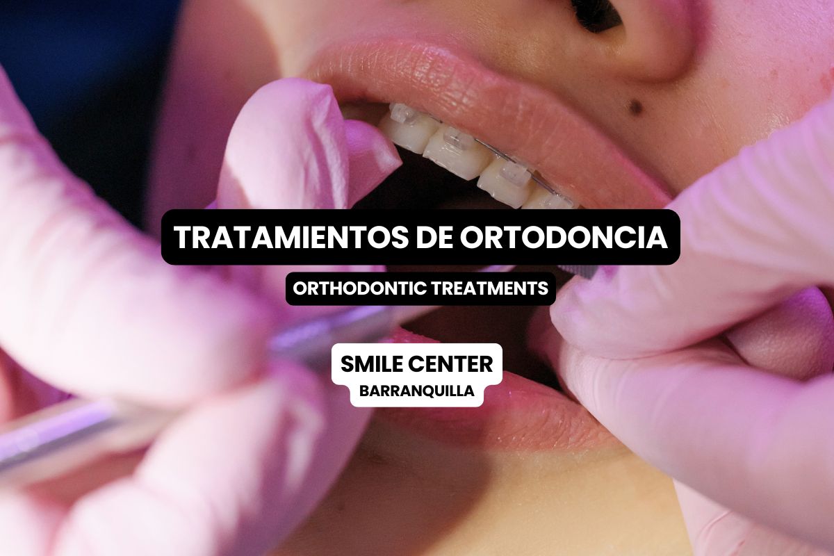 Ortodoncia en Barranquilla: corrige tu sonrisa con tratamiento personalizado