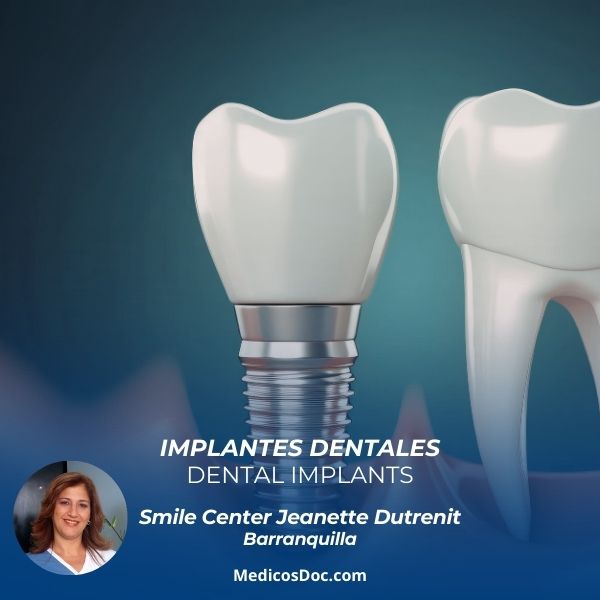 Dental implants