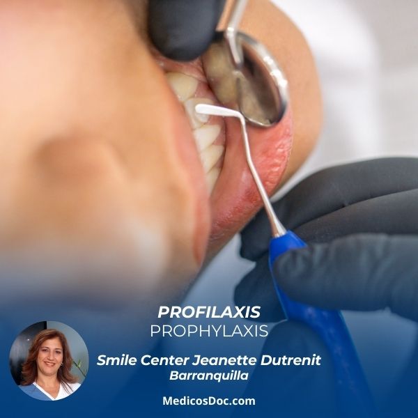 Dental prophylaxis