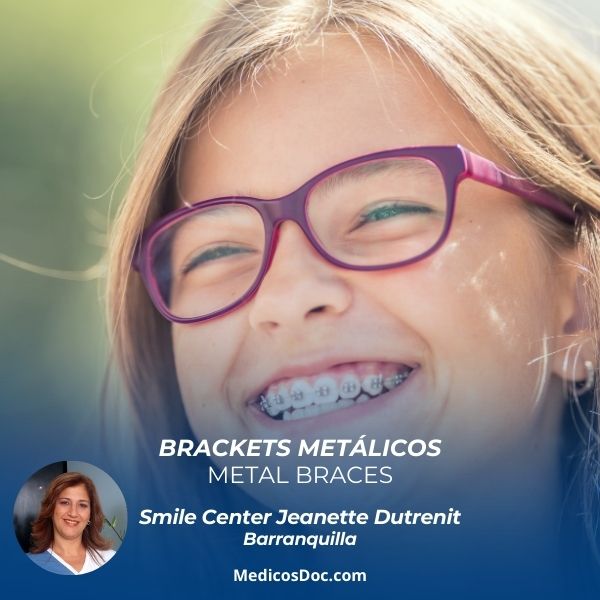 Metal braces