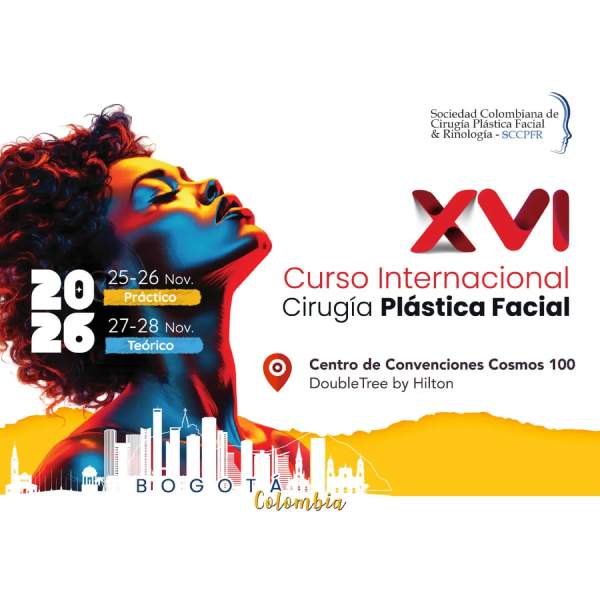 Evento 1
