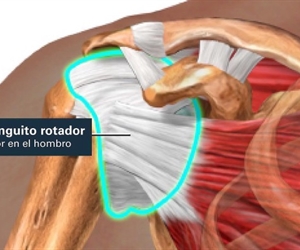 Todo lo que necesitas saber sobre el Manguito Rotador: Guía del Dr. Andrés De la Espriella