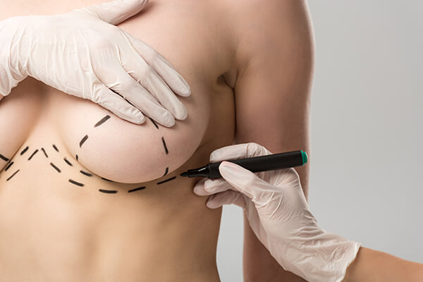 MaBreast surgery in Colombia