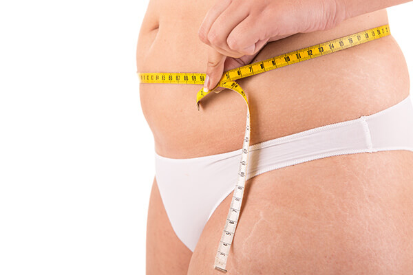 Liposuction  Colombia