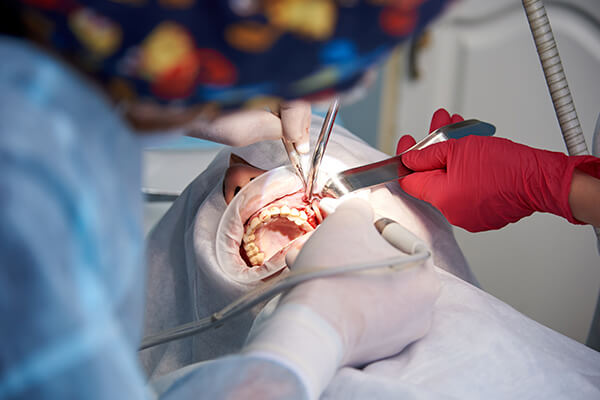 Dental implant by maxillofacial surgeon in Barranquilla