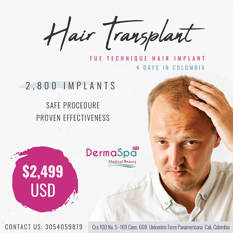  hair transplant cali colombia