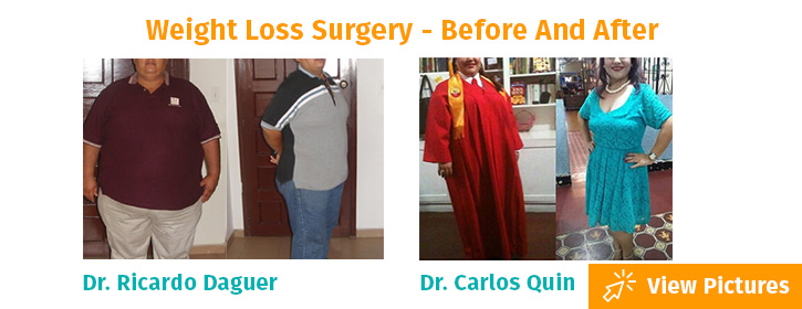 weight loss surgery Cartagena Colombia
