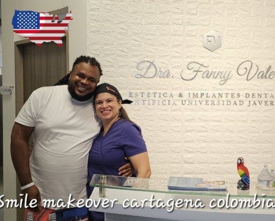 Fanny Valera Smile Makeover Cartagena  Odontólogo